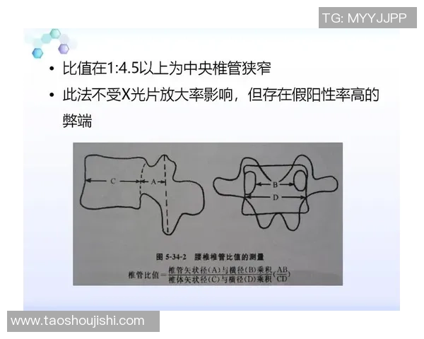 北京乒乓球队区域防守策略解析及其在比赛中的应用探讨